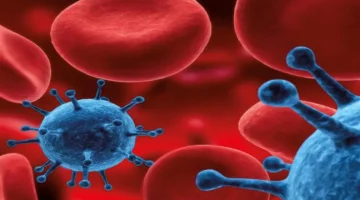 علاج سرطان الدم النقوي المتعدد يعزز فرص التحسن بعد 5 سنوات من التجارب السريرية 1